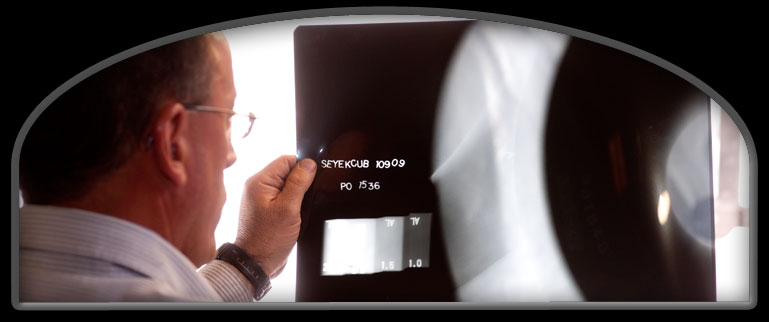 Seyekcub Aluminum Radiograph